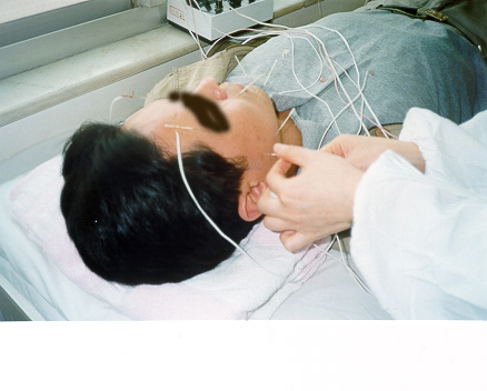 acupuncture-4.jpg