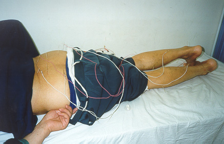 acupuncture-6.jpg